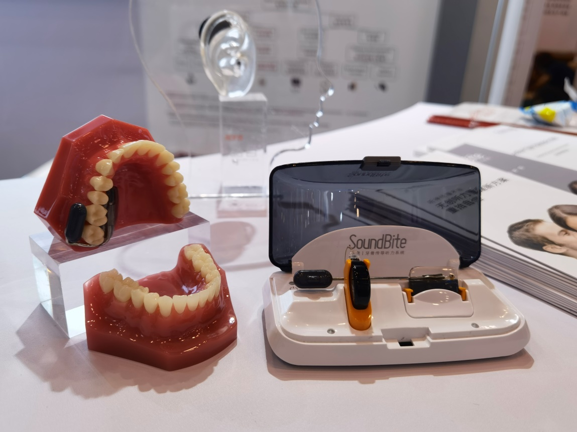 凤凰新闻报道《用牙齿竟能听声音 牙骨传导黑科技惊艳国内最高水平学术会议》(图2)
